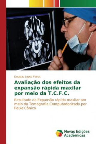 Kniha Avaliacao dos efeitos da expansao rapida maxilar por meio da T.C.F.C. Lopes Flores Douglas