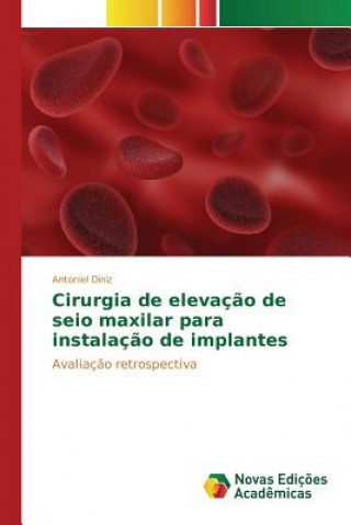 Kniha Cirurgia de elevacao de seio maxilar para instalacao de implantes Diniz Antoniel