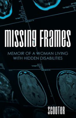 Книга Missing Frames Scooter