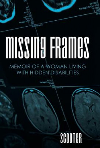 Knjiga Missing Frames Scooter