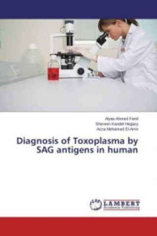 Carte Diagnosis of Toxoplasma by SAG antigens in human Alyaa Ahmed Farid