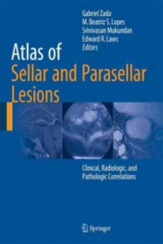 Könyv Atlas of Sellar and Parasellar Lesions Gabriel Zada