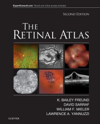 Knjiga Retinal Atlas K. Bailey Freund