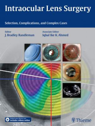 Książka Intraocular Lens Surgery Bradley Randleman