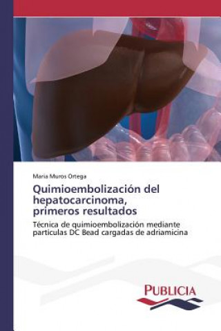 Knjiga Quimioembolizacion del hepatocarcinoma, primeros resultados Muros Ortega Maria