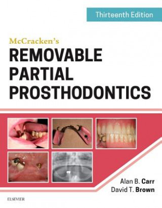 Kniha McCracken's Removable Partial Prosthodontics Alan B Carr