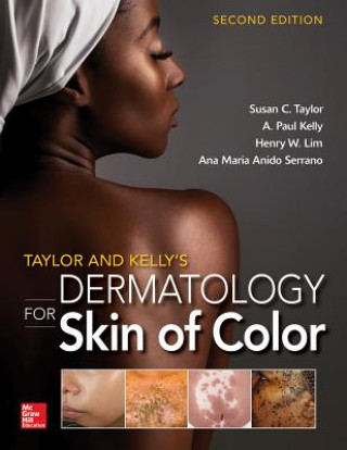 Könyv Taylor and Kelly's Dermatology for Skin of Color 2/E Susan Taylor