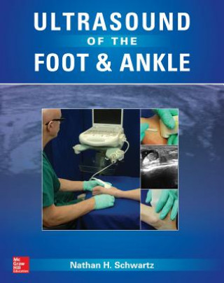 Książka Ultrasound of the Foot and Ankle Nathan Schwartz