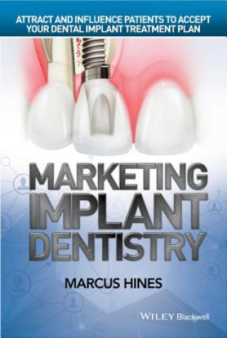 Carte Marketing Implant Dentistry - Attract and Influence Patients to Accept Your Dental Implant Treatment Plan Marcus Hines