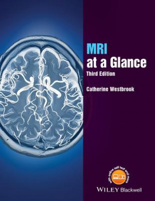 Kniha MRI at a Glance 3e Catherine Westbrook