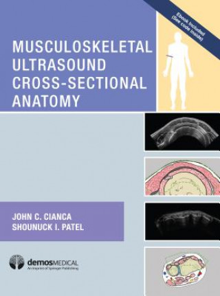 Kniha Musculoskeletal Ultrasound Cross-Sectional Anatomy John C. Cianca