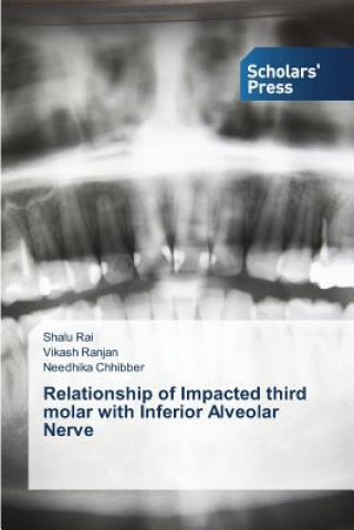 Kniha Relationship of Impacted third molar with Inferior Alveolar Nerve Rai Shalu