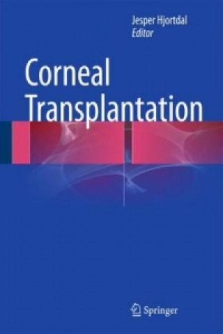 Kniha Corneal Transplantation Jesper Hjortdal