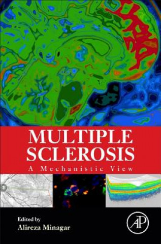 Kniha Multiple Sclerosis Alireza Minagar