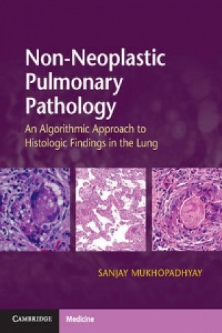 Könyv Non-Neoplastic Pulmonary Pathology with Online Resource Sanjay Mukhopadhyay