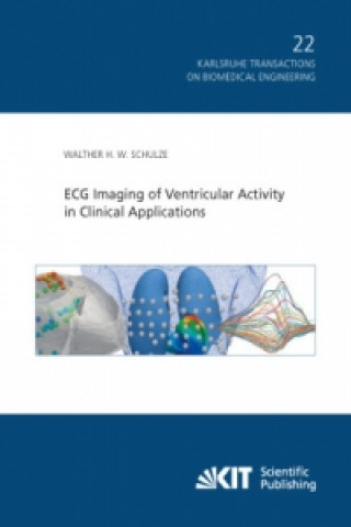 Kniha ECG Imaging of Ventricular Activity in Clinical Applications Walther H. W. Schulze