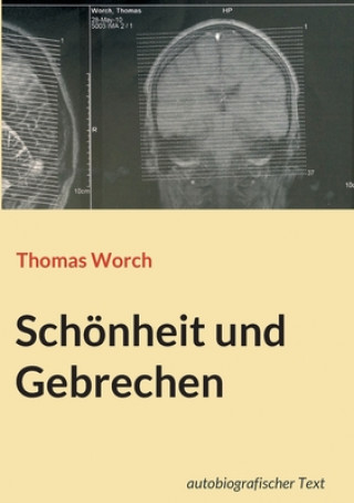 Kniha Schoenheit und Gebrechen Thomas Worch