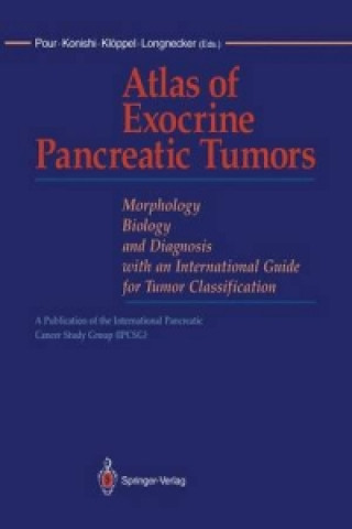 Carte Atlas of Exocrine Pancreatic Tumors Günter Klöppel