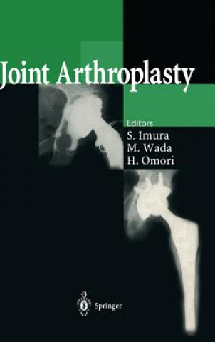 Kniha Joint Arthroplasty Shinichi Imura