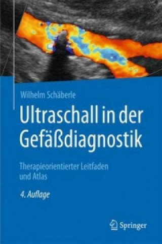 Knjiga Ultraschall in der Gefadiagnostik Wilhelm Schäberle