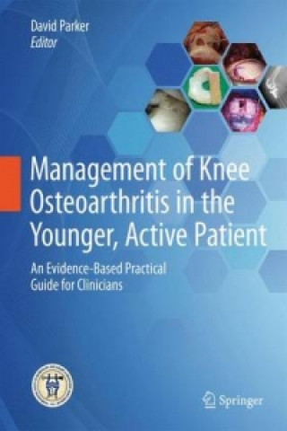 Kniha Management of Knee Osteoarthritis in the Younger, Active Patient David Parker