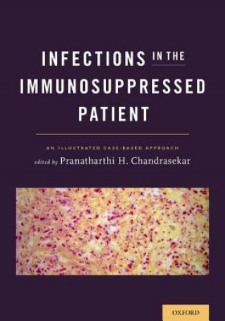 Kniha Infections in the Immunosuppressed Patient Pranatharthi H Chandrasekar
