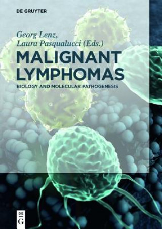 Knjiga Malignant Lymphomas Georg Lenz