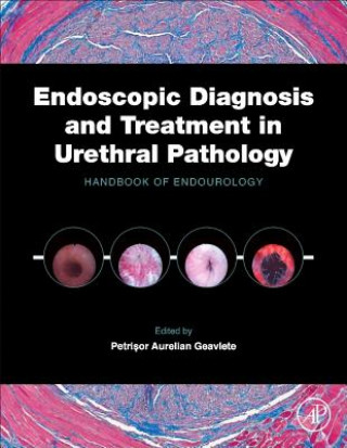 Könyv Endoscopic Diagnosis and Treatment in Urethral Pathology Petri?orAurelian Geavlete