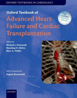 Kniha Oxford Textbook of Advanced Heart Failure and Cardiac Transplantation Michael Domanski