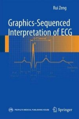 Kniha Graphics-sequenced interpretation of ECG Rui Zeng