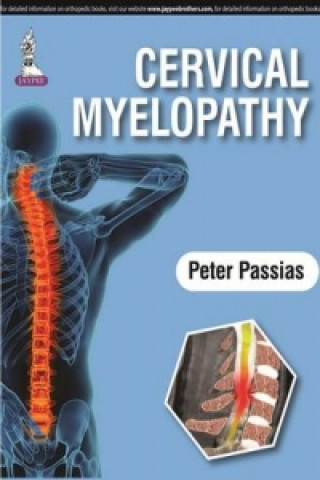 Könyv Cervical Myelopathy Peter Passias