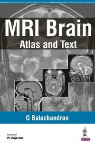 Kniha MRI Brain G. Balachandran