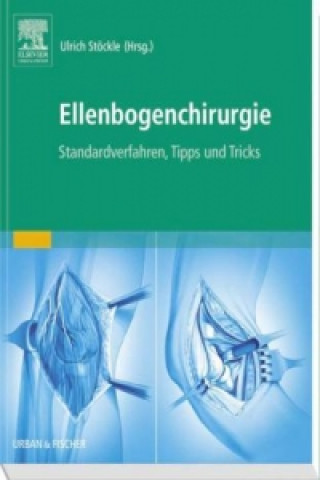 Libro Ellenbogenchirurgie Ulrich Stöckle