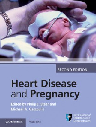 Könyv Heart Disease and Pregnancy Philip J. Steer