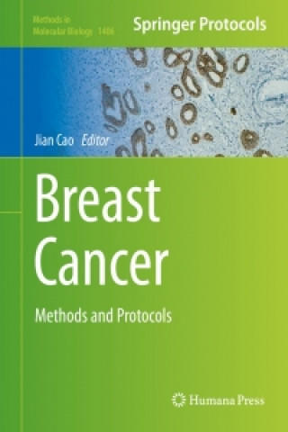 Kniha Breast Cancer Jian Cao