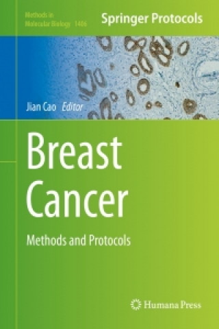 Książka Breast Cancer Jian Cao