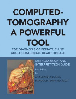 Könyv Computed-Tomography a Powerful Tool for Diagnosis of Pediatric and Adult Congenital Heart Disease Shakibi