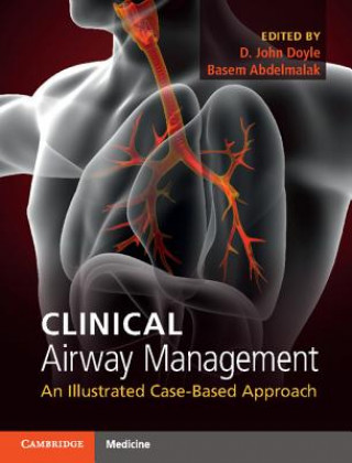Kniha Clinical Airway Management D. John Doyle