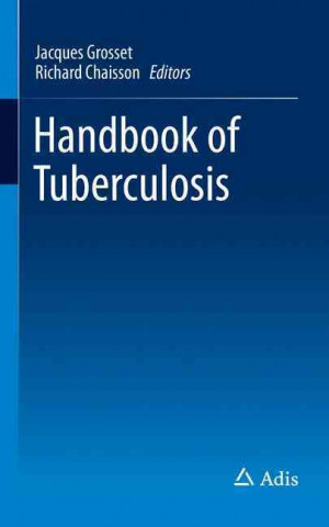 Carte Handbook of Tuberculosis Jacques H. Grosset