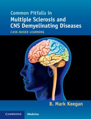 Könyv Common Pitfalls in Multiple Sclerosis and CNS Demyelinating Diseases B. Mark Keegan
