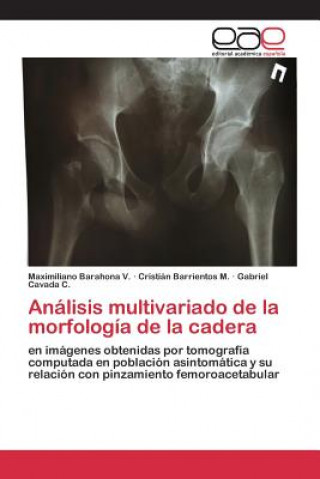 Könyv Analisis multivariado de la morfologia de la cadera Barahona V Maximiliano