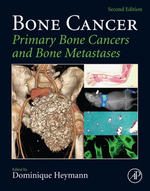 Libro electrónico Bone Cancer Dominique Heymann