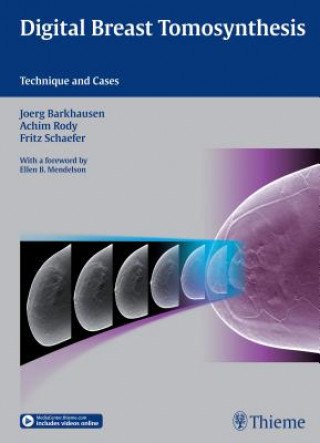 Carte Digital Breast Tomosynthesis Joerg Barkhausen