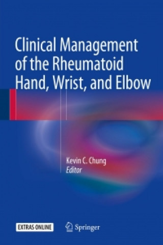 Könyv Clinical Management of the Rheumatoid Hand, Wrist, and Elbow Kevin C. Chung