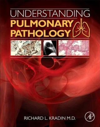 Könyv Understanding Pulmonary Pathology Richard Kradin