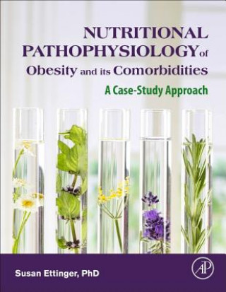 Kniha Nutritional Pathophysiology of Obesity and its Comorbidities Susan Ettinger