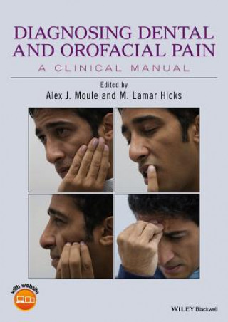 Kniha Diagnosing Dental and Orofacial Pain - A Clinical Manual Alex J. Moule