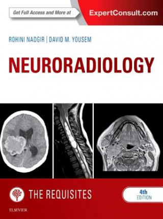 Książka Neuroradiology: The Requisites Rohini Nadgir