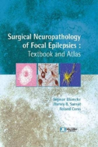 Könyv Surgical Neuropathology of Focal Epilepsies Ingmar Blumcke