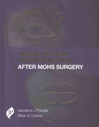 Könyv Aesthetic Facial Reconstruction After Mohs Surgery Mark A. Codner